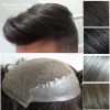 lace with skin hair replacement