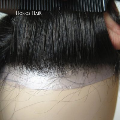 ultra thin skin hair replacement2